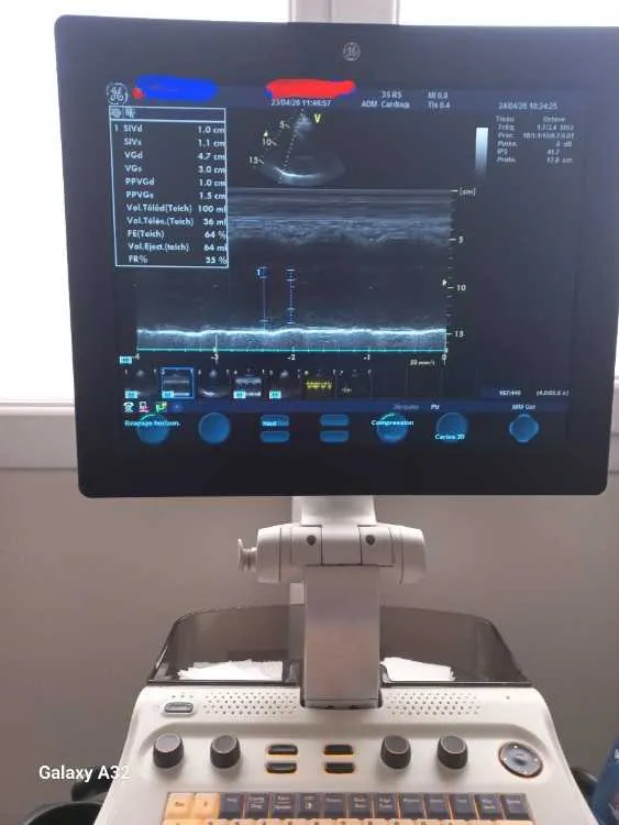 Echographe GE Vivid S5